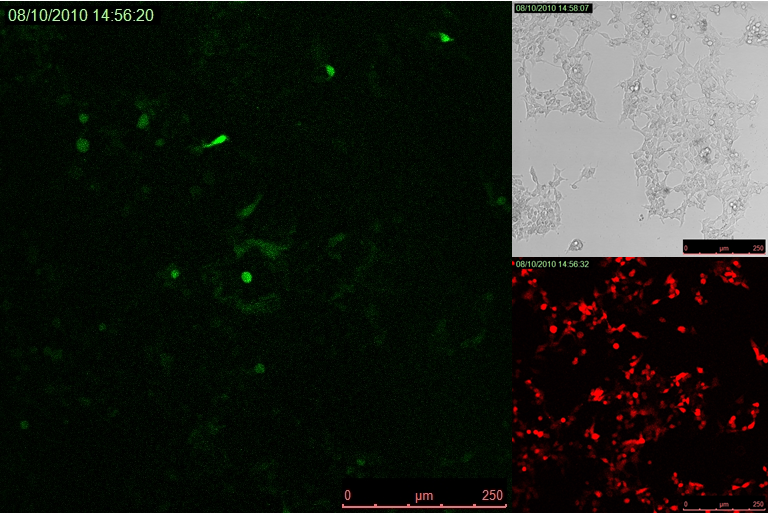 Figure 3: Expression of Venus without of the repressor. Cells transfected with Venus reporter under the control of promoter with TAL/TetR binding sequence immediately downstream of it exhibit fluorescence.