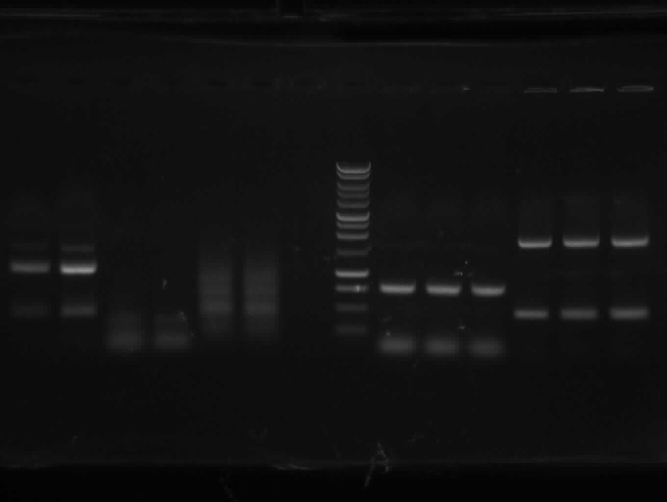 gel electrophoresis of PCR 1, 4a, 4b, 5, 7a