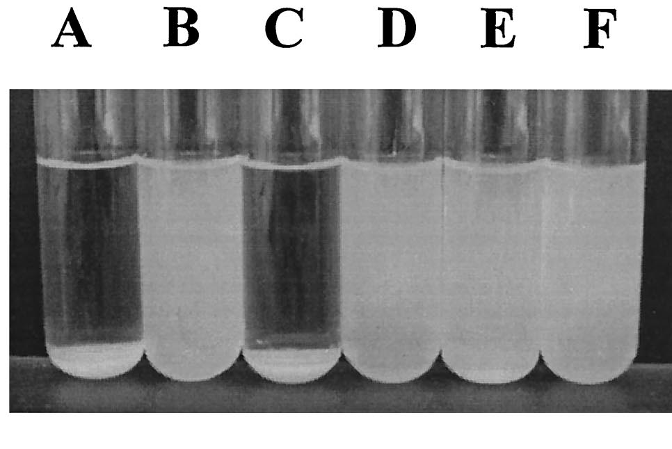 FIG. 8. Settling of cells from static liquid suspensions. (A) E. coli HEHA16(pKKJ101), (B) E. coli HEHA16(pUCP22), (C) P. fluorescens SBW25(pKKJ101), (D) P. fluorescens SBW25(pUCP22), (E) K. pneumoniae(pKKJ101), and (F) K. pneumoniae( pUCP22). [8]