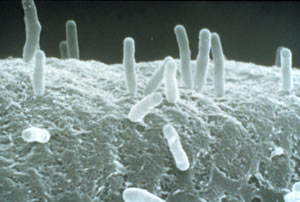 Bielefeld Agrobacterium tumefaciens attached to a plant cell Image by Martha Hawe.jpg