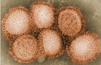 H1N1 INFLUENZA A VIRUS