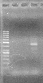 Lethbridge 100809 HB xylE Lum PCR BW.jpg