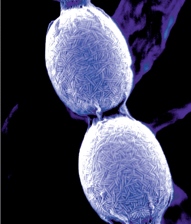 Electron microscopy picture showing S. coelicolor spores on which chaplins can be seen clearly as rod-like structures. Cover of Journal of Bacteriology, September 2008.