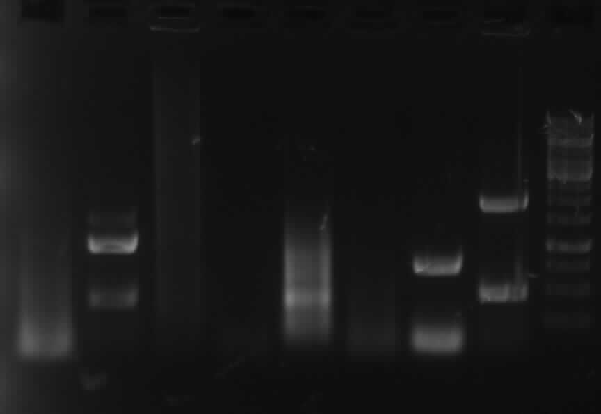 gel electrophoresis of PCR 1, 3, 4a, 5, 7a, 9, 10