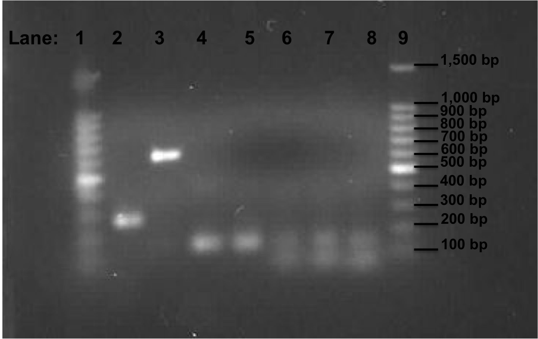 Newcastle 050810 PCR 100bp second gel.png