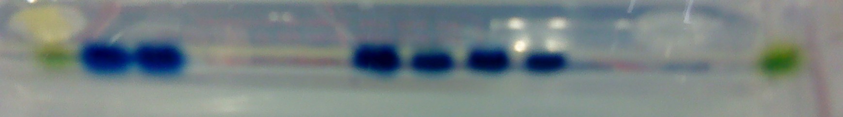 The gel loaded up with the amplified PCR products (blue) and the ladders on either side (green), carried out to check the size of the sequences. Please see results section below for key.