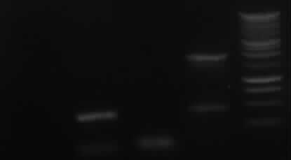 gel electrophoresis of new PCR 7a,7b, 9, 10