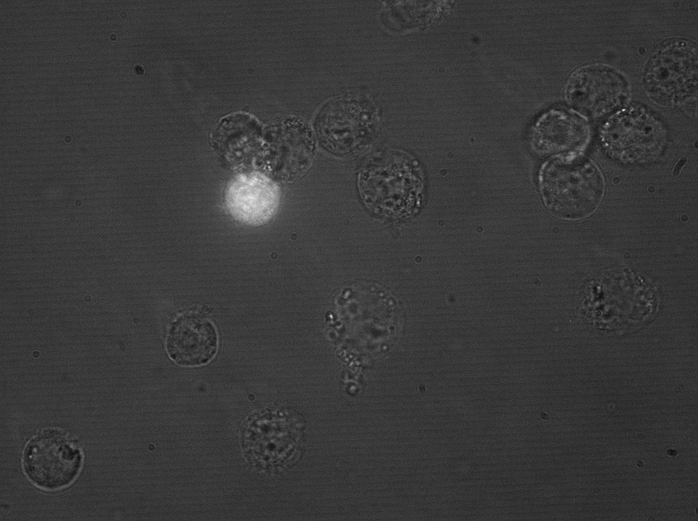 Clone 43 under microscope, HepG2 cells