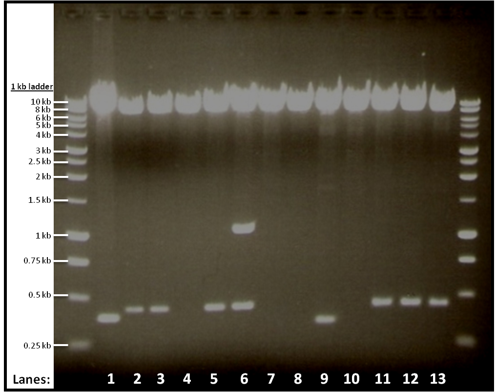 Newcastle 25-08-2010 – Gel 1 (Ethidium Bromide).png