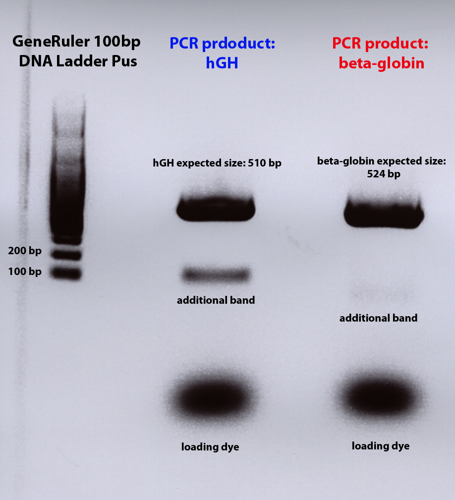 Freiburg10 PCR of hGH and Bet a globin repeat agaorse gel 28 07 2010008.jpg