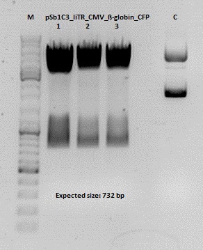 Freiburg10 Test digestion of pSB1C3 lITR CMV ß-globin CFP.jpg